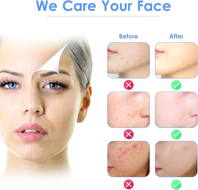 🌸 3-in-1 Ultrasonic Facial Skin Scrubber | جهاز تنظيف الوجه & ماسك للبشرة 🌸