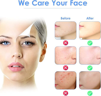 🌸 3-in-1 Ultrasonic Facial Skin Scrubber | جهاز تنظيف الوجه & ماسك للبشرة 🌸
